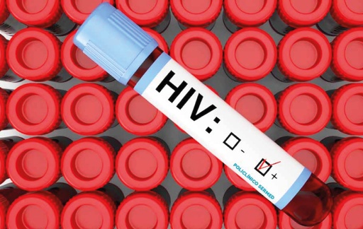 [466] Hiv tipo 1 / 2